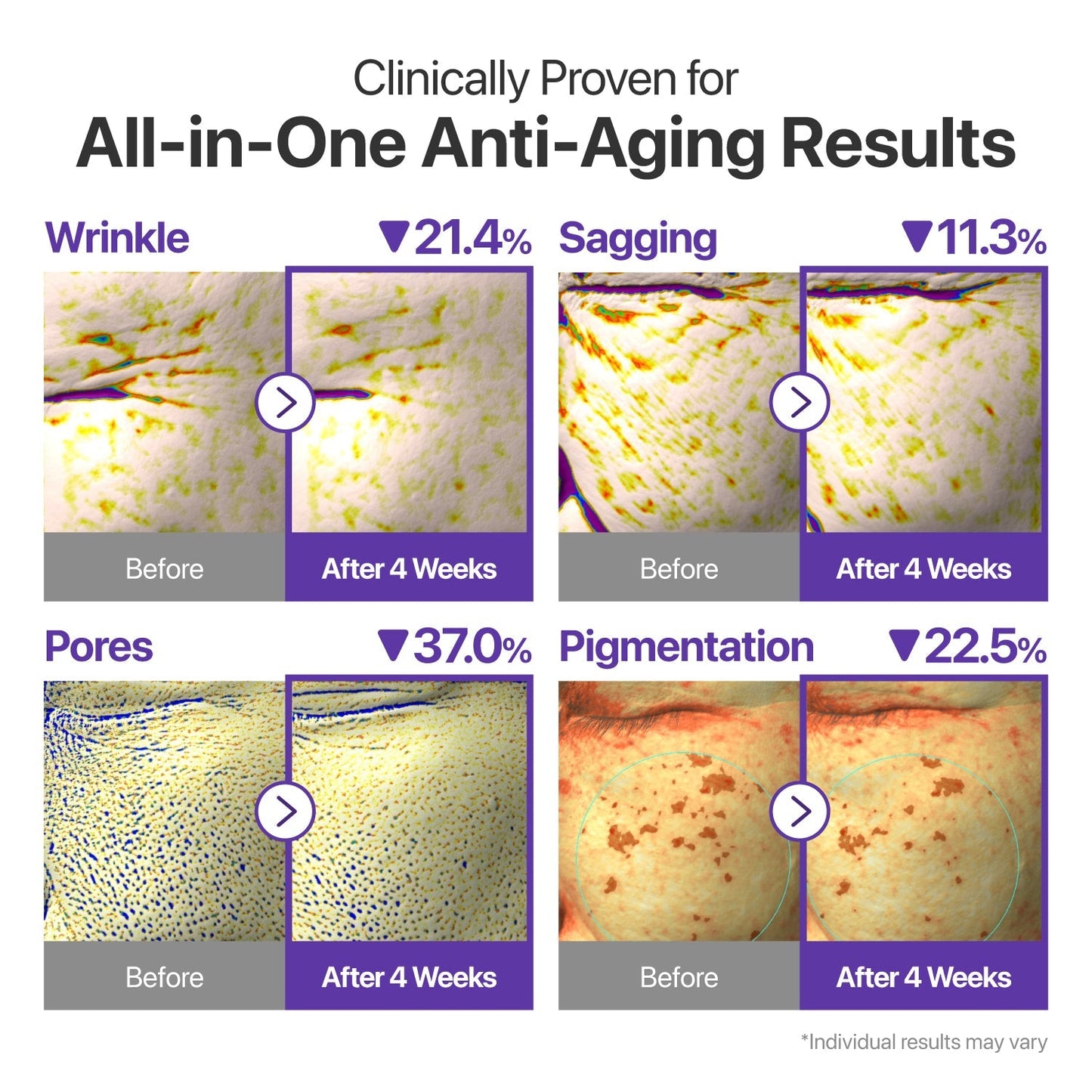 Liposome-encapsulated retinal delivers gentle wrinkle smoothing without irritation