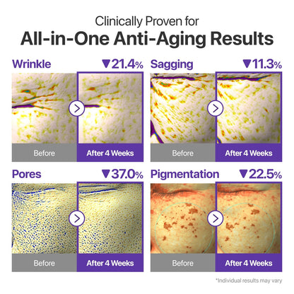 Liposome-encapsulated retinal delivers gentle wrinkle smoothing without irritation
