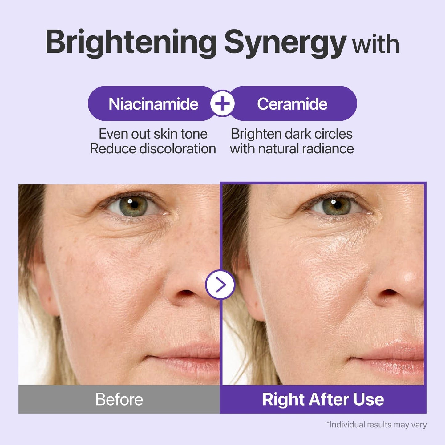 Niacinamide and Ceramide NP brighten dark circles and strengthen skin barrier