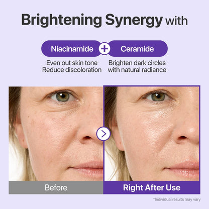 Niacinamide and Ceramide NP brighten dark circles and strengthen skin barrier