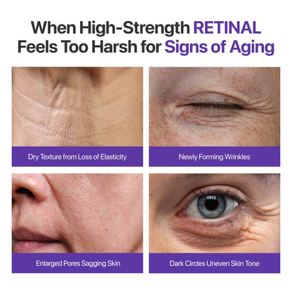 Gentle enough for full face use on smile lines forehead creases and fine lines