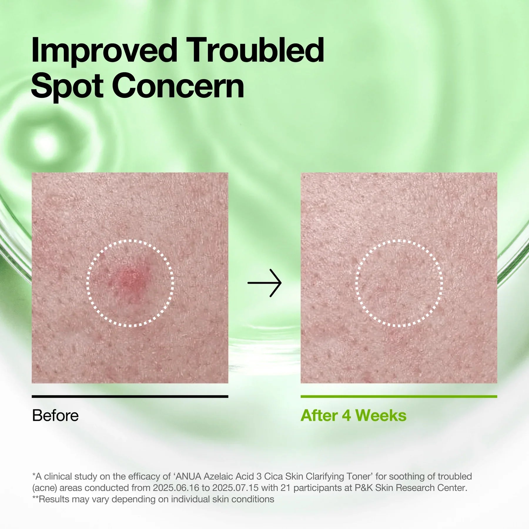 Azelaic 3 Cica Skin Clarifying Toner with azelaic acid and cica for soothing and clarifying skin.
