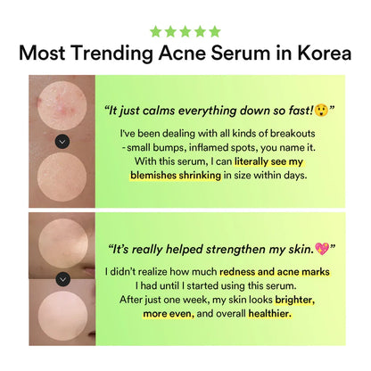 Abib Heartleaf TECA Capsule Serum Calming Drop – 50ml / 1.69 fl.oz Airless Pump Bottle