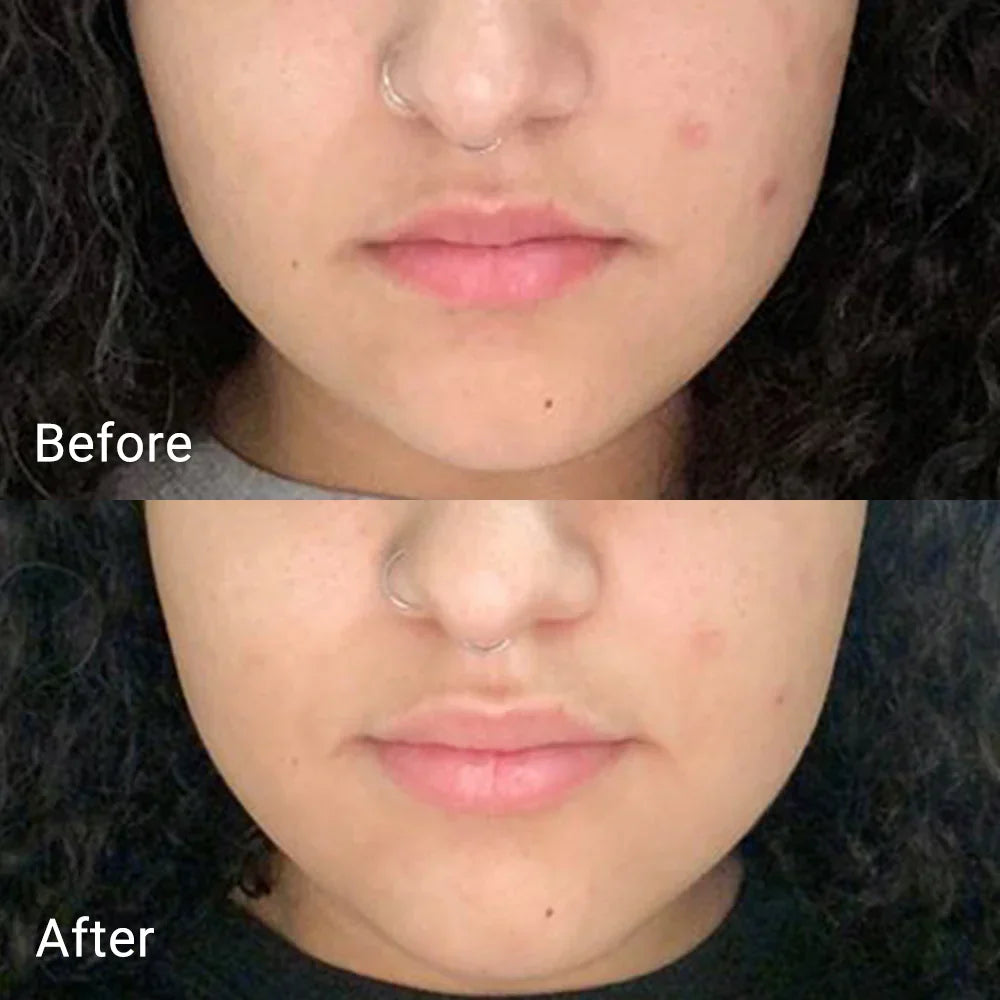APRILSKIN Real Calendula Peel Off Pack — peel-off pack that purifies and soothes skin