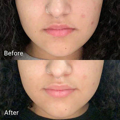 APRILSKIN Real Calendula Peel Off Pack — peel-off pack that purifies and soothes skin