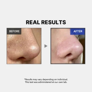 Medicube One Day Exosome Shot Pore Ampoule 2000 - 30ml - product benefit image 2