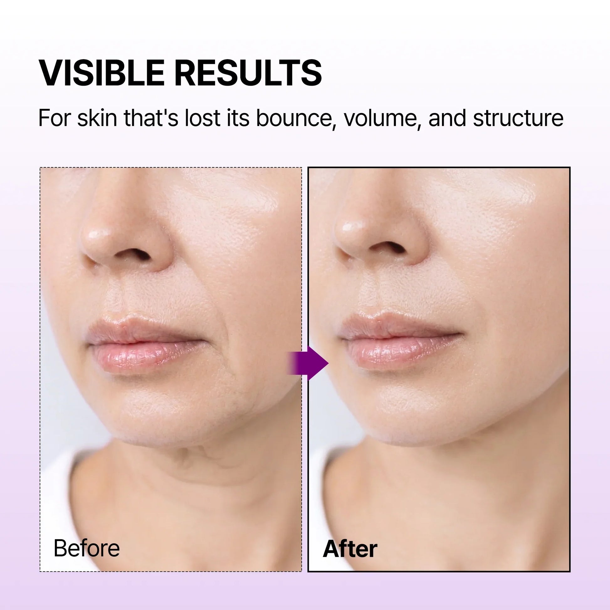 Dr.Melaxin Calcium Bonding Facial Cream — calcium bonding complex