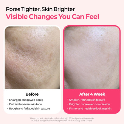 Dr.Melaxin Cemenrete Cyano Pink Spicule Serum — how to use