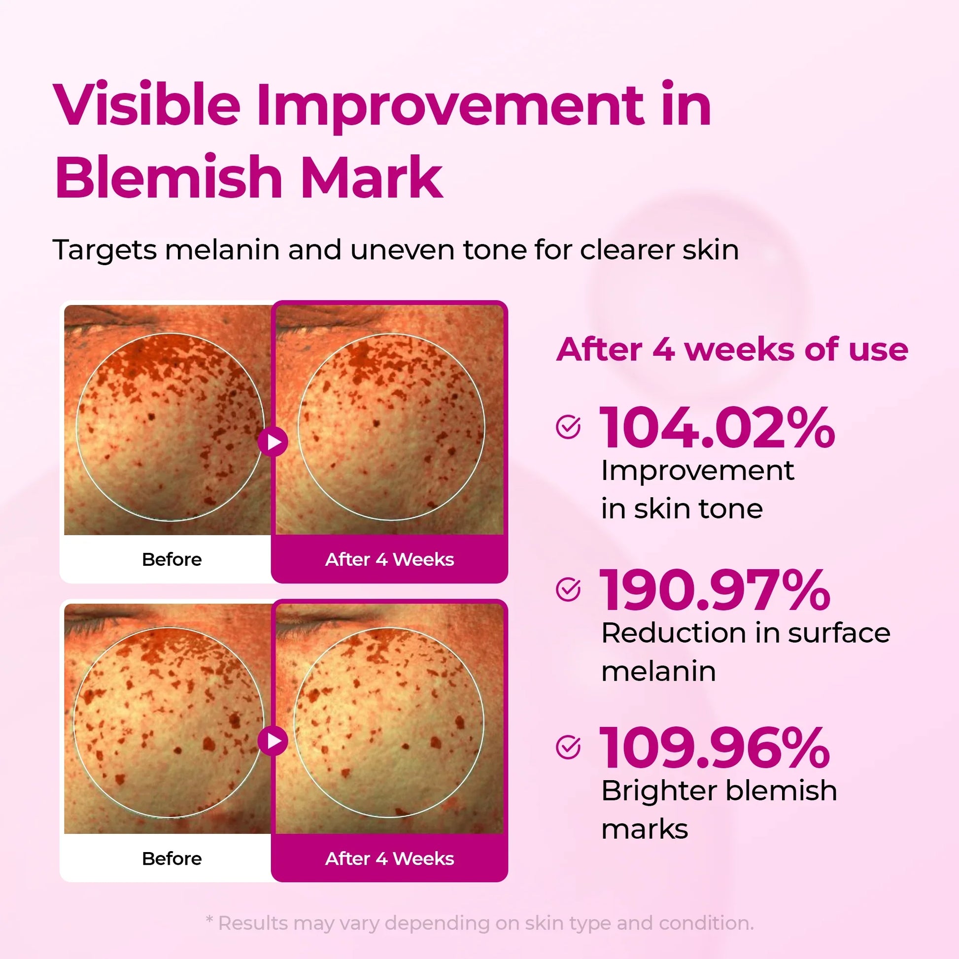 Dr.Melaxin Cemenrete Picotonic Shot Pigmentation Serum — fades pigmentation