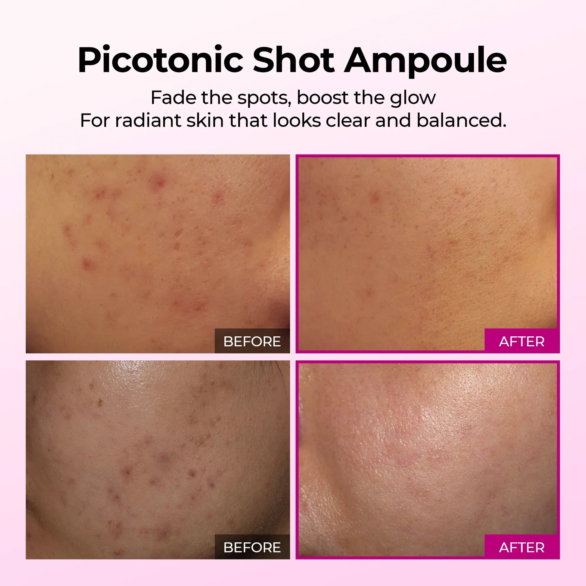 Dr.Melaxin Cemenrete Picotonic Shot Pigmentation Serum — brightening complex