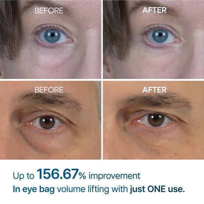 Dr.Melaxin Eyephalt Eyebag Cream — firming complex