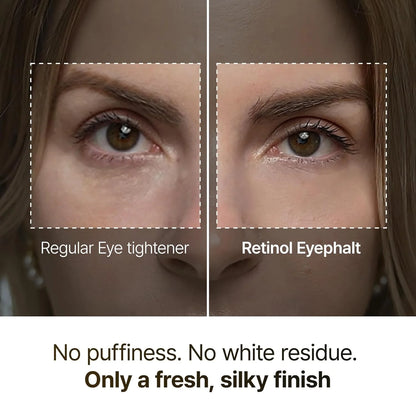 Dr.Melaxin Eyephalt Retinol Eyebag Cream — retinol complex