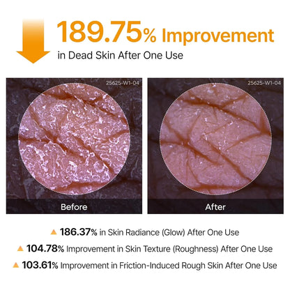 Dr.Melaxin Peel Shot Exfoliating Kojic Acid Turmeric Spray — smooths rough skin
