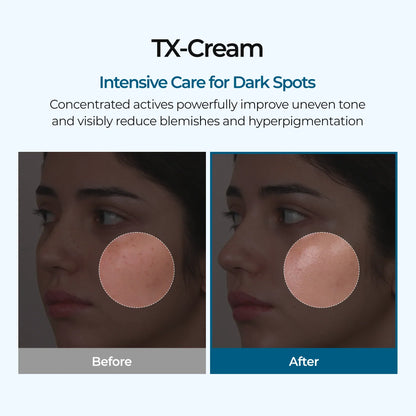 Dr.Melaxin TX Tranexamic Acid Cream — tranexamic acid formula