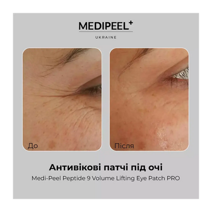 MEDI-PEEL Peptide 9 Volume Lifting Eye Patch Pro — peptides firm and lift the under-eye area
