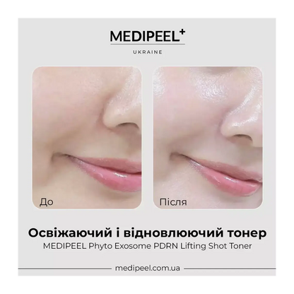 MEDI-PEEL Phyto Exosome PDRN Lifting Shot Toner — preps and hydrates skin after cleansing