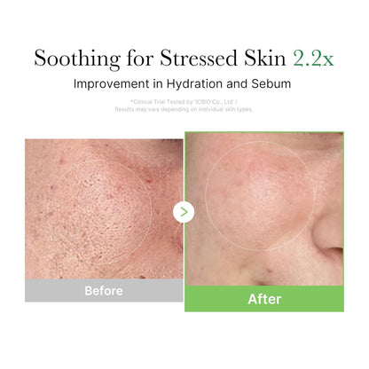 Fragrance-free Exosome Cica cream that controls sebum and strengthens the skin barrier for all skin types