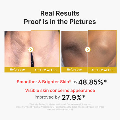 BHA, LHA and PHA that remove dead skin and smooth rough, bumpy body skin