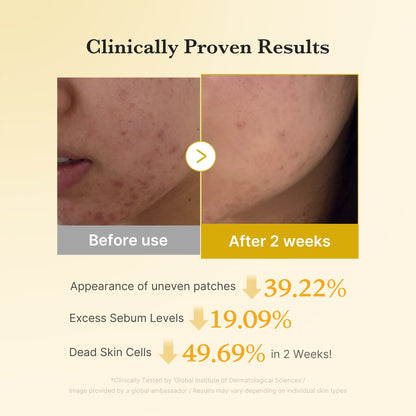 Kojic acid and turmeric that fade dark spots and acne scars