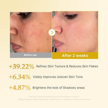 Kojic acid and turmeric that brighten dark spots and even skin tone