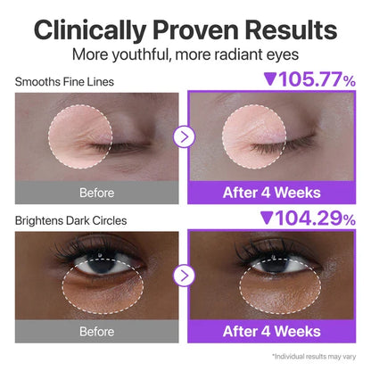 Numbuzin No.9 NAD Retinol Volumetox Eye Cream — targets the look of dark circles
