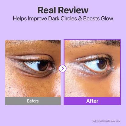 Numbuzin No.9 NAD Retinol Volumetox Eye Cream — helps de-puff and refresh tired eyes