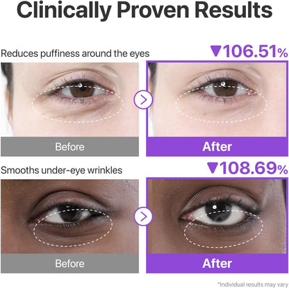 Numbuzin No.9 NAD Under Eye Patches — drench the eye area in concentrated essence