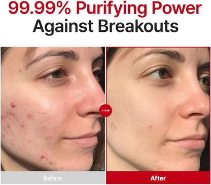 Purito Seoul Hypochlorous Acid Rescue Spray — lightweight mist refreshes skin anytime
