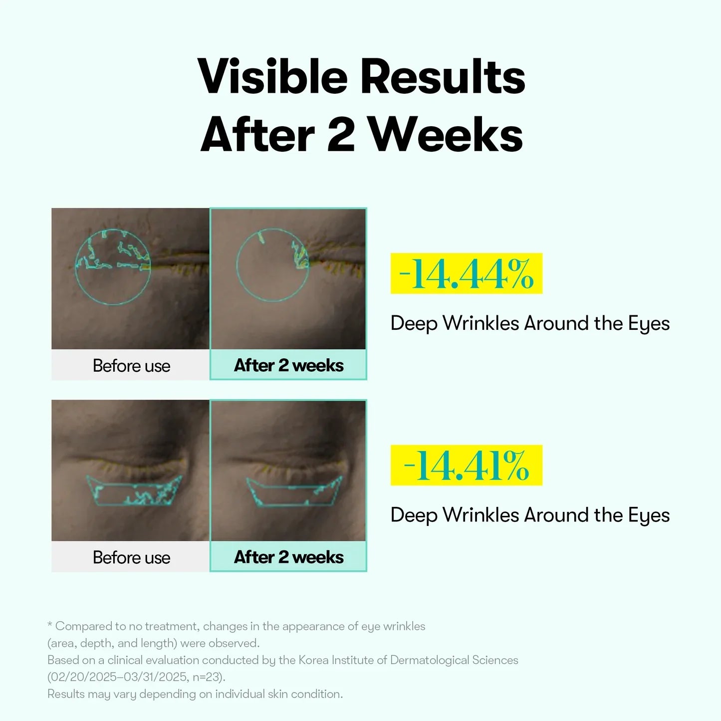 VT Cosmetics PDRN Reedle Shot Eye Lifter — PDRN complex