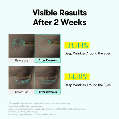 VT Cosmetics PDRN Reedle Shot Eye Lifter — PDRN complex