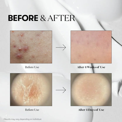 VT Cosmetics Reedle Shot 100 — application