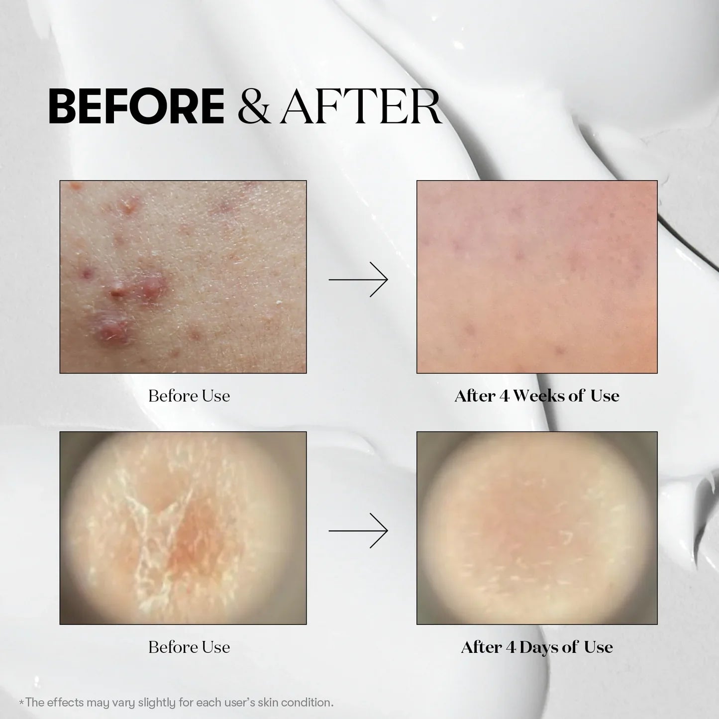 VT Cosmetics Reedle Shot 300 — firm smooth skin